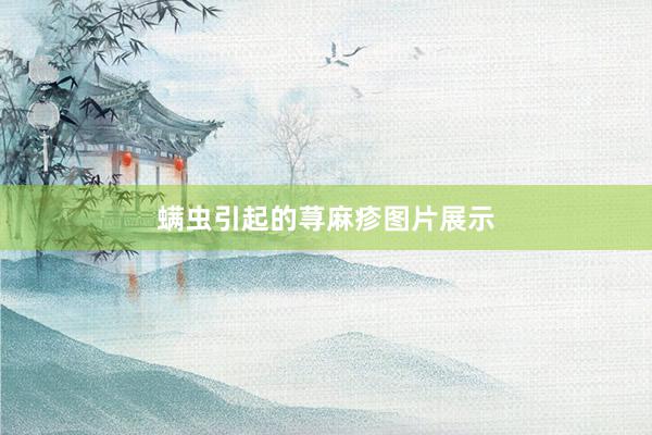 螨虫引起的荨麻疹图片展示
